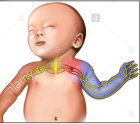 L’esame EMG nel neonato